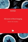 Advances in Brain Imaging By Vikas Chaudhary (Editor) Cover Image