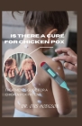 Is There a Cure for Chicken Pox: Treatments Guide for a Chicken Pox Patient Cover Image
