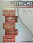 Toothwear: The ABC of the Worn Dentition By Farid Khan (Editor), William G. Young (Editor), Adrian Lussi (Foreword by) Cover Image