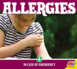 Allergies Cover Image