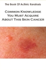 The Book Of Actinic Keratosis_ Common Knowledge You Must Acquire About This Skin Cancer: Skin Cancer Books Cover Image