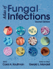 Atlas of Fungal Infections Cover Image