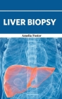 Liver Biopsy By Amelia Foster (Editor) Cover Image