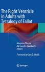 The Right Ventricle in Adults with Tetralogy of Fallot Cover Image
