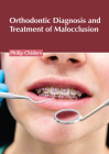 Orthodontic Diagnosis and Treatment of Malocclusion Cover Image