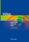 Vitiligo By Mauro Picardo (Editor), Alain Taïeb (Editor) Cover Image