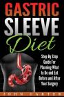 Gastric Sleeve Diet: Step By Step Guide For Planning What to Do and Eat Before and After Your Surgery Cover Image