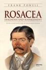 Rosacea: Diagnosis and Management Cover Image