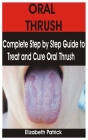 Oral Thrush: Complete Step by Step Guide to Treat and Cure Oral Thrush By Elizabeth Patrick Cover Image