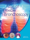 Atlas of Flexible Bronchoscopy By Pallav Shah Cover Image