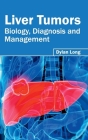 Liver Tumors: Biology, Diagnosis and Management By Dylan Long (Editor) Cover Image