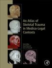 An Atlas of Skeletal Trauma in Medico-Legal Contexts Cover Image