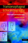Transoesophageal Echocardiography: Study Guide and Practice Questions By Andrew Roscoe Cover Image