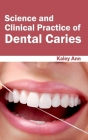 Science and Clinical Practice of Dental Caries By Kaley Ann (Editor) Cover Image