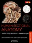 Human Sectional Anatomy: Atlas of Body Sections, CT and MRI Images, Fourth Edition By Adrian K. Dixon, David J. Bowden, Harold Ellis Cover Image