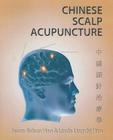 Chinese Scalp Acupuncture By Jason Jishun Hao, Linda Lingzhi Hao Cover Image