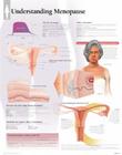 Understanding Menopause Chart: Wall Chart Cover Image
