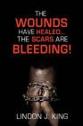 The Wounds Have Healed....The Scars Are Bleeding! By Lindon J. King Cover Image