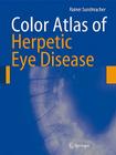 Color Atlas of Herpetic Eye Disease: A Practical Guide to Clinical Management By Rainer Sundmacher Cover Image