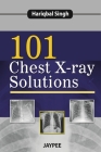 101 Chest X-Ray Solutions Cover Image