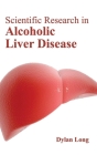 Scientific Research in Alcoholic Liver Disease By Dylan Long (Editor) Cover Image