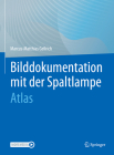 Bilddokumentation Mit Der Spaltlampe: Atlas By Marcus-Matthias Gellrich Cover Image
