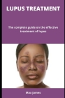 Lupus Treatment: The complete guide on the effective treatment of lupus By Max James Cover Image