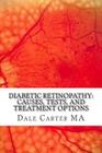 Diabetic Retinopathy: Causes, Tests, and Treatment Options By Edward Montgomery (Editor), Dale Carter Ma Cover Image
