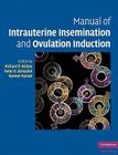 Manual of Intrauterine Insemination and Ovulation Induction Cover Image