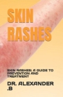 Skin Rashes: Skin Rashes: A Guide to Prevention and Treatment By Alexander B Cover Image