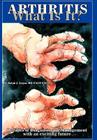 Arthritis what is it?: Decades of Diagnosis and Management with an exciting future Cover Image