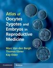 Atlas of Oocytes, Zygotes and Embryos in Reproductive Medicine Hardback [With CDROM] Cover Image