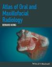 Atlas of Oral and Maxillofacial Radiology By Bernard Koong Cover Image