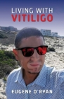 Living with Vitiligo By Eugene O'Ryan Cover Image