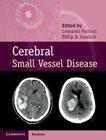 Cerebral Small Vessel Disease By Leonardo Pantoni (Editor), Philip B. Gorelick (Editor) Cover Image
