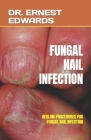 Fungal Nail Infection: Healing Procedures for Fungal Nail Infection By Ernest Edwards Cover Image