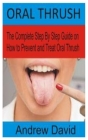 Oral Thrush: The Complete Step By Step Guide on How to Prevent and Treat Oral Thrush By Andrew David Cover Image