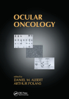 Ocular Oncology Cover Image