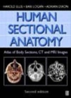 Human Sectional Anatomy: Atlas of Body Sections, CT and MRI Images Cover Image