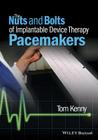 The Nuts and Bolts of Implantable Device Therapy: Pacemakers Cover Image