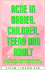 Acne in Babies, Children, Teens and Aduilt: Fіnd оut hоw аnd whу асnе hарреn&# By Ethan Phillips Rnd Cover Image