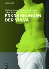 Erkrankungen Der Vulva Cover Image