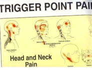 Travell and Simons' Trigger Point Pain Patterns Wall Charts By Janet Travell, MD, David Simons Cover Image