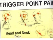 Travell and Simons' Trigger Point Pain Patterns Wall Charts Cover Image