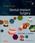 Color Atlas of Dental Implant Surgery By Michael S. Block Cover Image