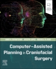 Computer-Assisted Planning in Craniofacial Surgery By Amir H. Dorafshar, Joseph Lopez, Russell R. Reid Cover Image