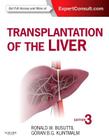 Transplantation of the Liver By Ronald W. Busuttil, Goran B. Klintmalm Cover Image