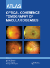 Atlas of Optical Coherence Tomography of Macular Diseases Cover Image