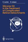Silicone Oil in the Treatment of Complicated Retinal Detachments: Techniques, Results, and Complications Cover Image