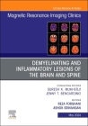Demyelinating and Inflammatory Lesions of the Brain and Spine, an Issue of Magnetic Resonance Imaging Clinics of North America: Volume 32-2 (Clinics: Radiology #32) Cover Image